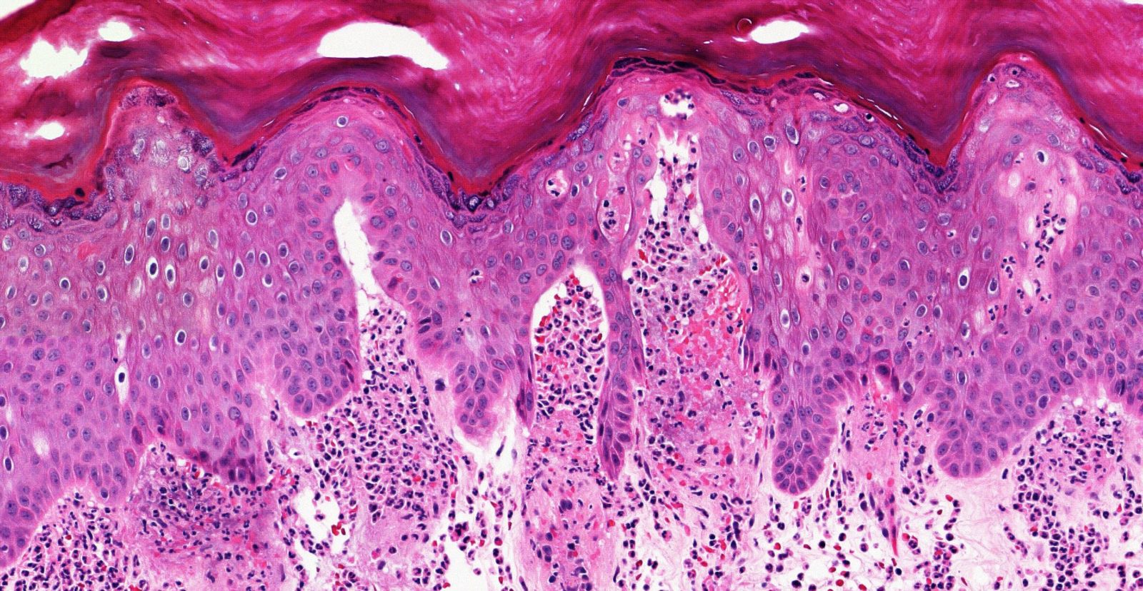 Dermatopathology reglab